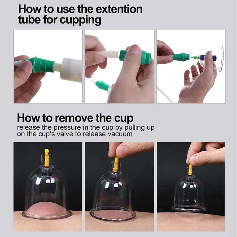 Vacuum Cupping Body Massager(50% OFF Last Day!!!)
